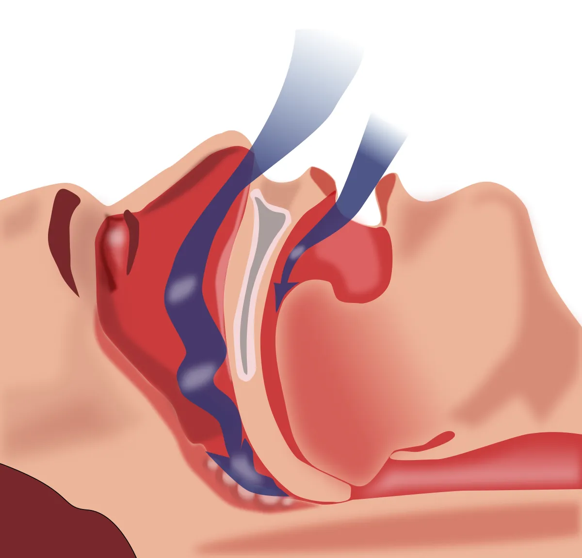 Side cross-section of a sleeping person's head with the tongue and soft palate against the throat