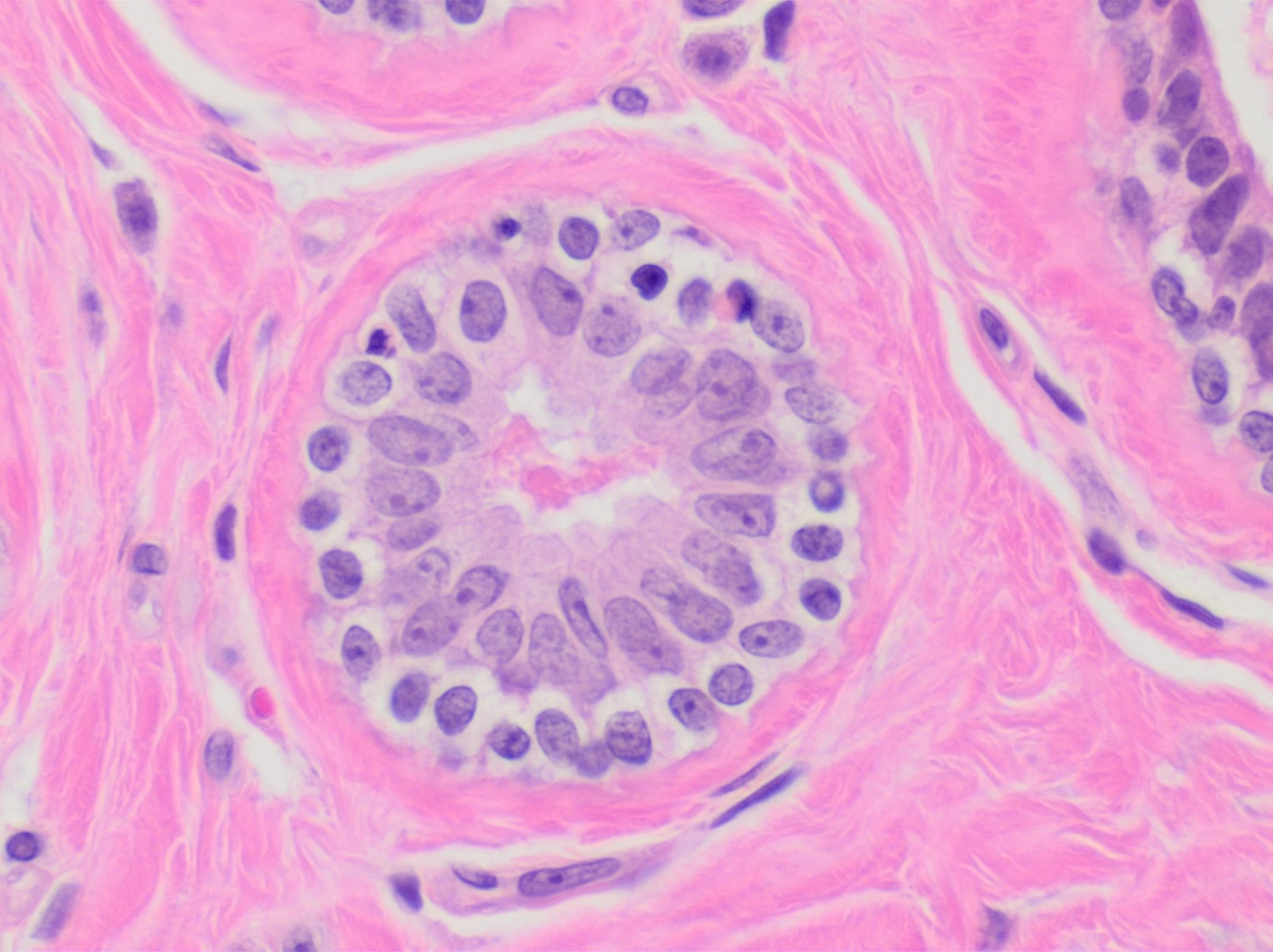 H&E micrograph of an unremarkable breast acinus, with orderly cells surrounding an open lumen