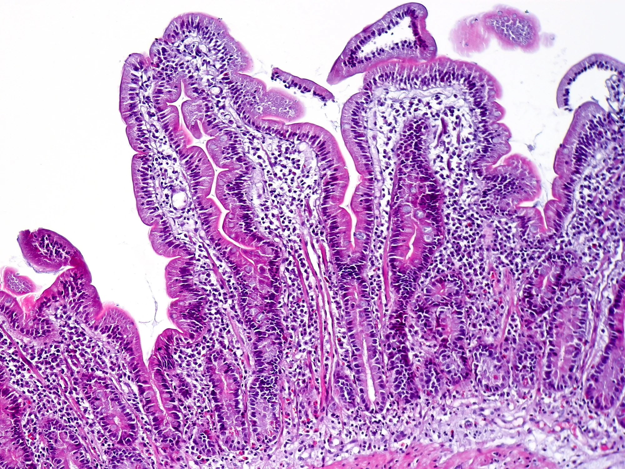 Biopsy of a healthy human duodenum, stained with hematoxylin and eosin: tall, finger-shaped villi covered by an unbroken layer of cells