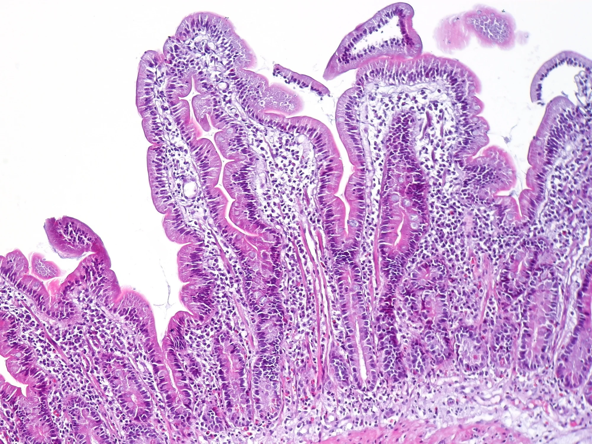 Hematoxylin and eosin micrograph of a duodenal biopsy showing villi and their cellular lining; species not documented by the source