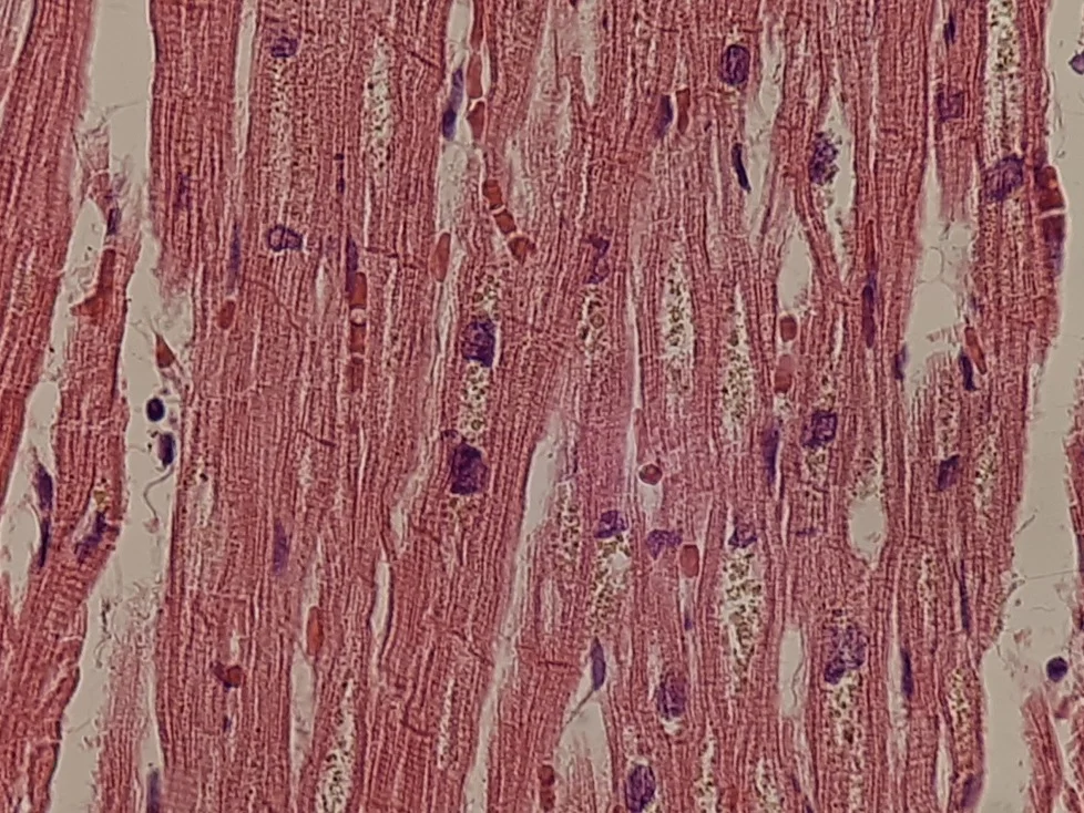 Micrograph of heart muscle with clusters of golden lipofuscin granules next to nuclei