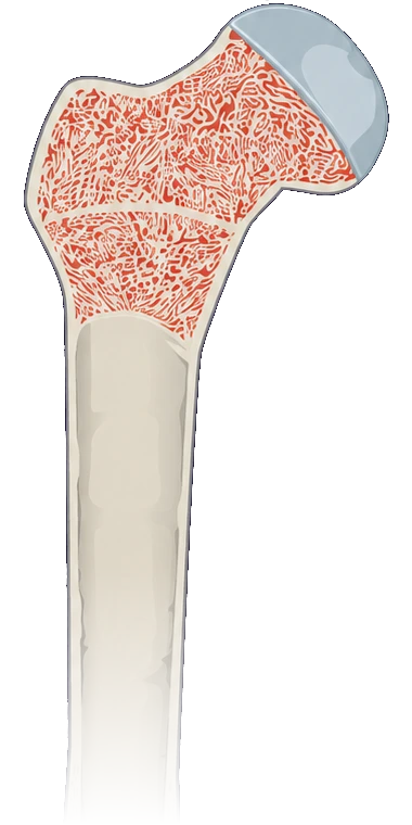The end of a long bone cut open: inside, spongy bone filled with red bone marrow