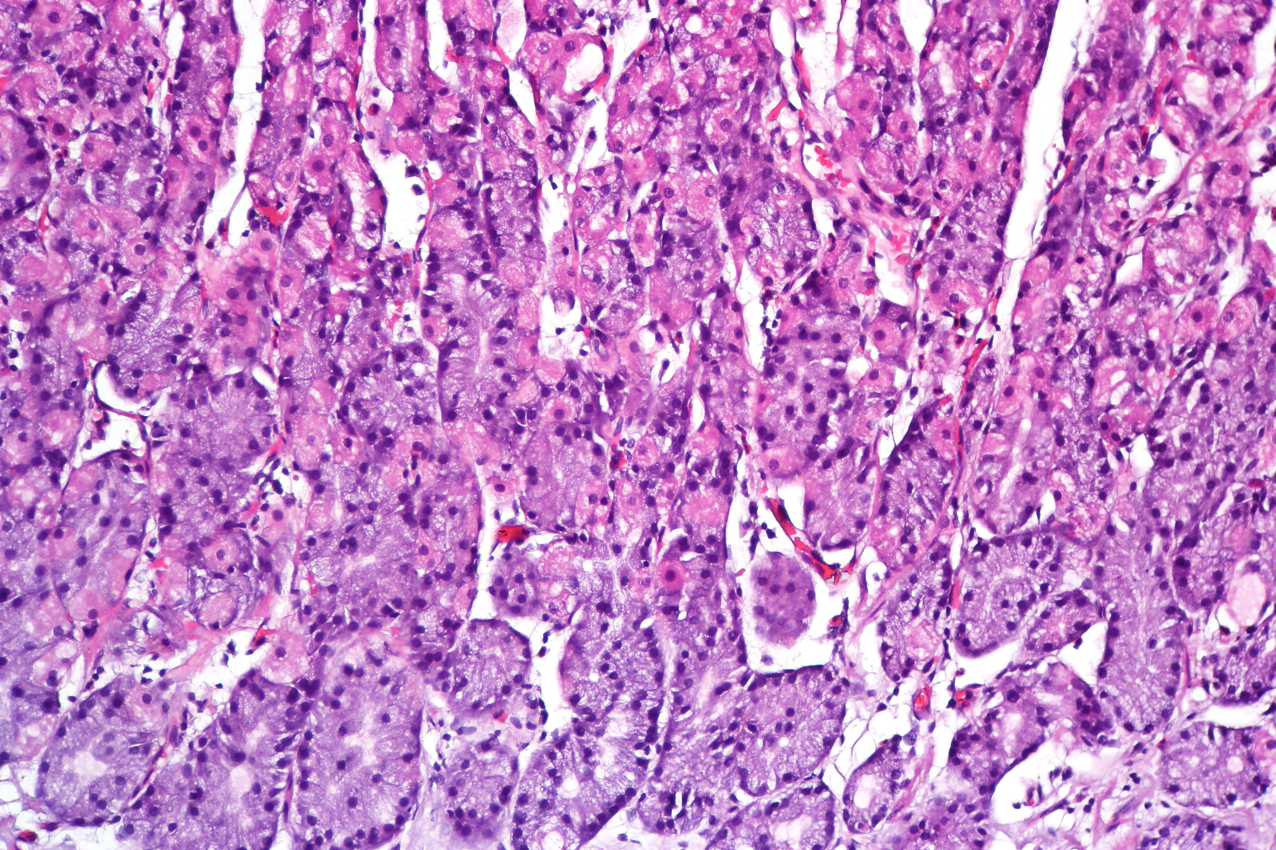 H&E micrograph of gastric oxyntic mucosa without inflammation
