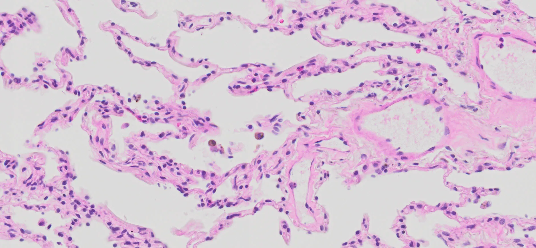 Normal lung tissue under the microscope. Micrograph by Carlo De la Sancha.