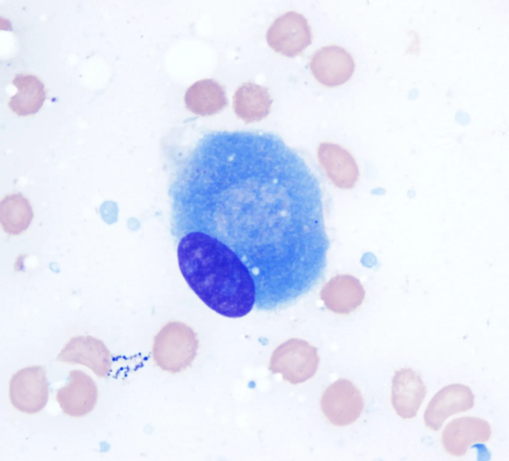 Micrograph of a blue osteoblast in the center with a purple nucleus, without labels or arrows