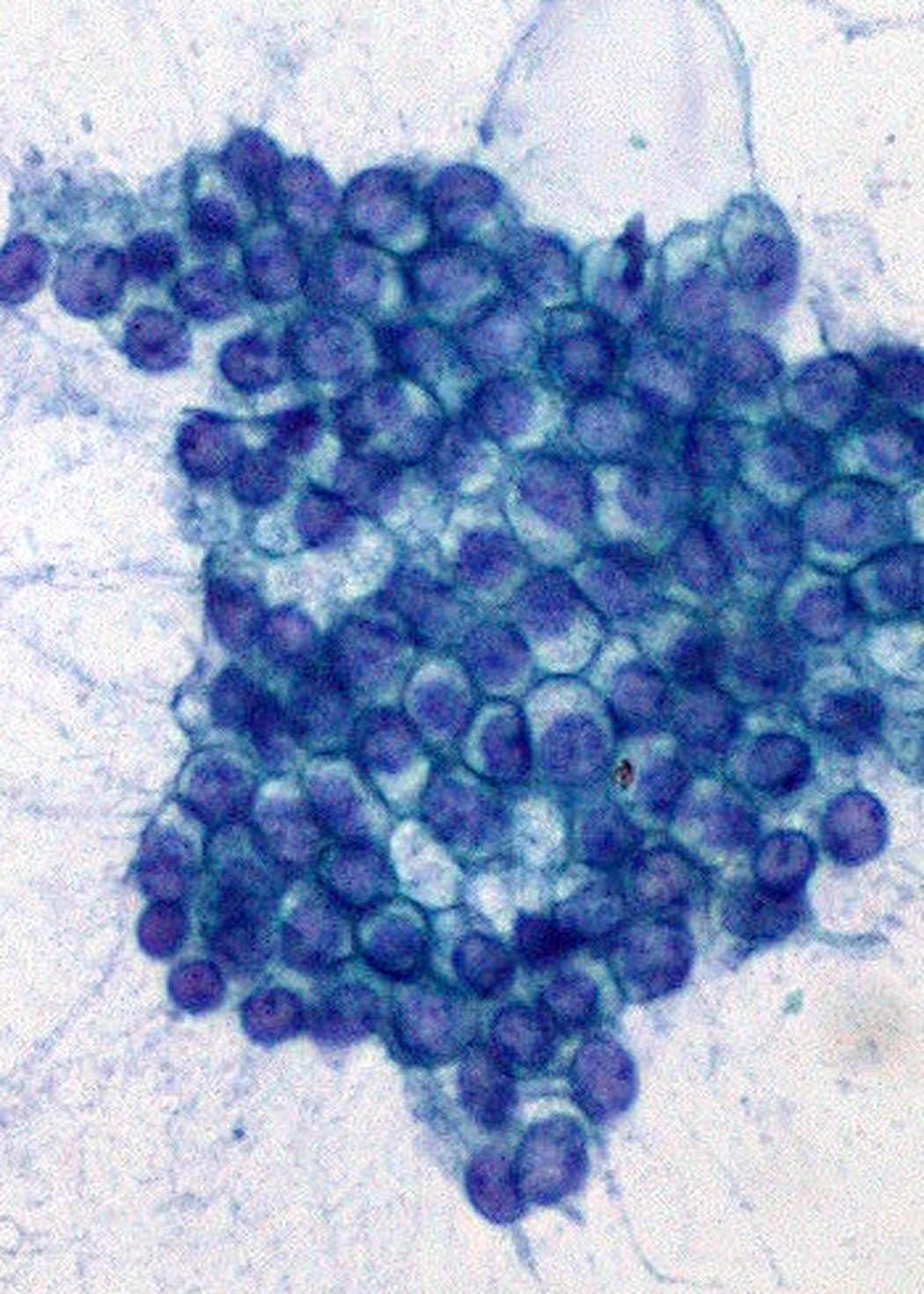 Cells from the normal lining of a pancreatic duct, with dark nuclei of regular size and spacing.