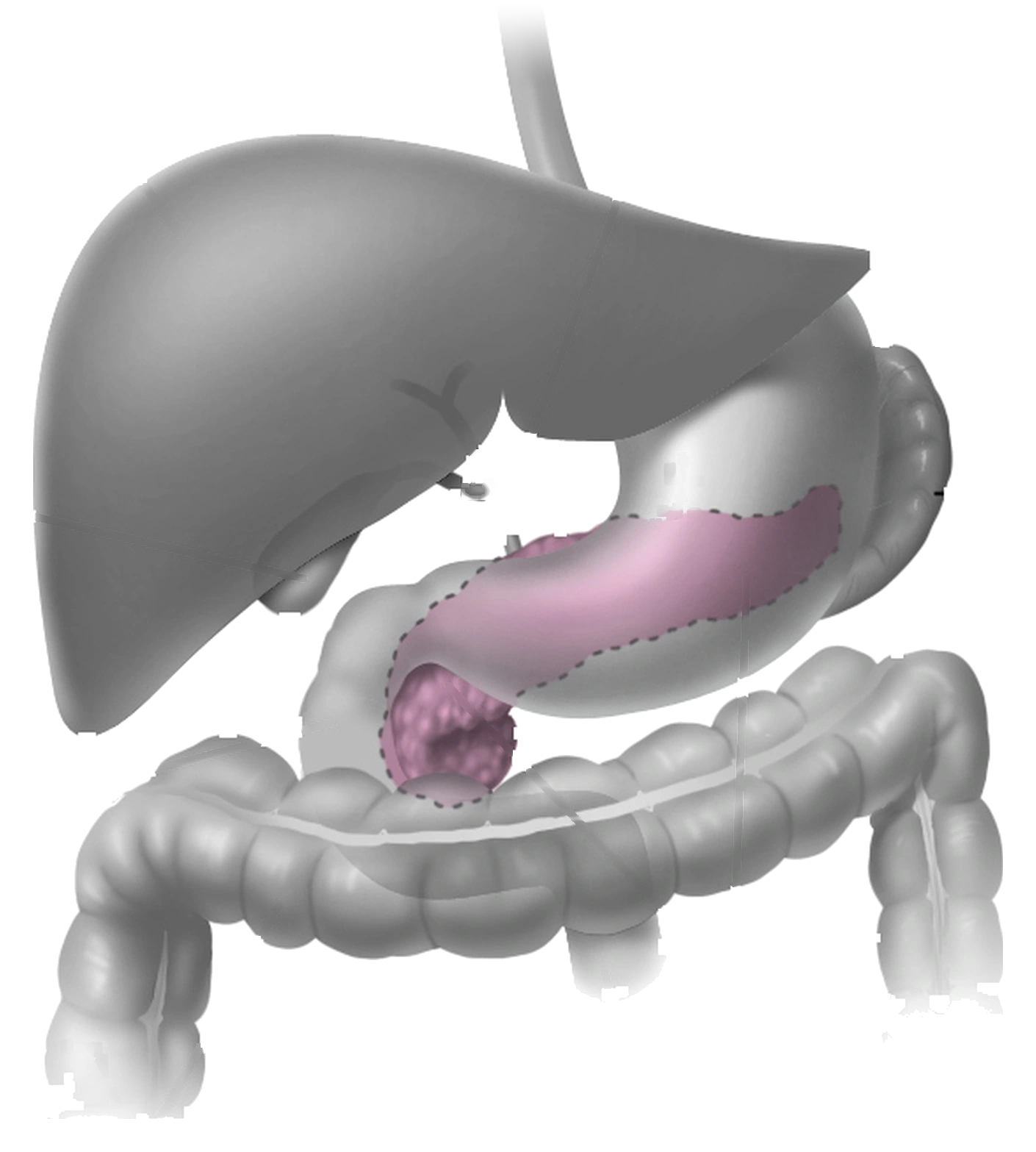 Pancreas behind the stomach and beside the duodenum