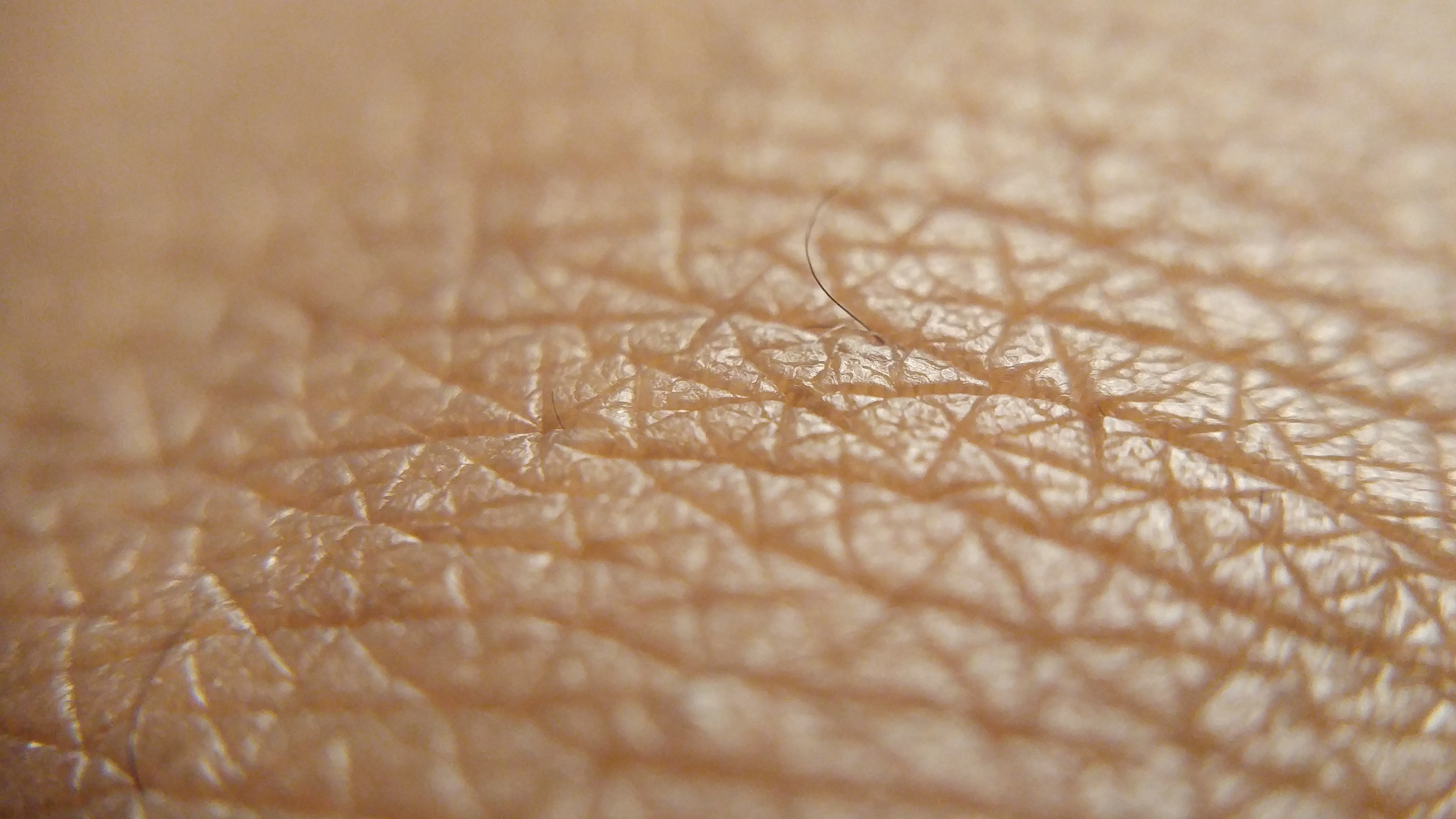 Close-up of the surface of normal human skin