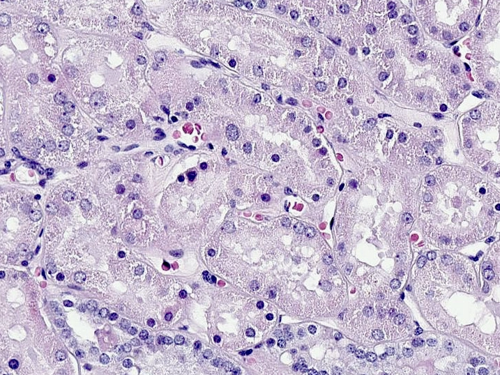 Normal human kidney cortex stained with hematoxylin and eosin: tubules lined by a thick layer of cells around a small central space
