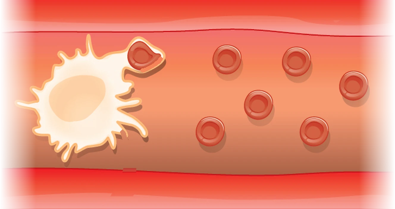 Inside a blood vessel, a macrophage (a large, pale cell) removes an old red blood cell