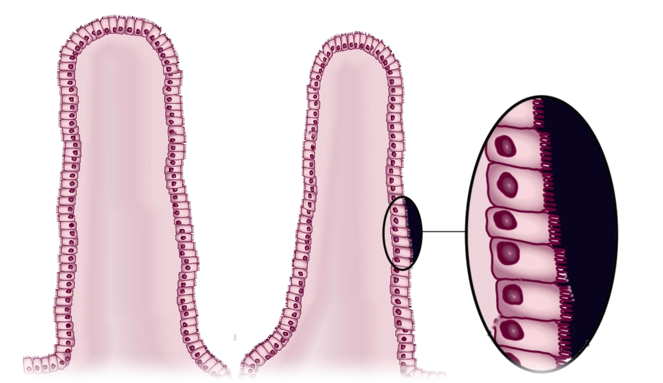 Diagram of two villi in the small intestine covered by a layer of enterocytes, with a magnified oval showing the cells, their nuclei and the microvilli on their surface
