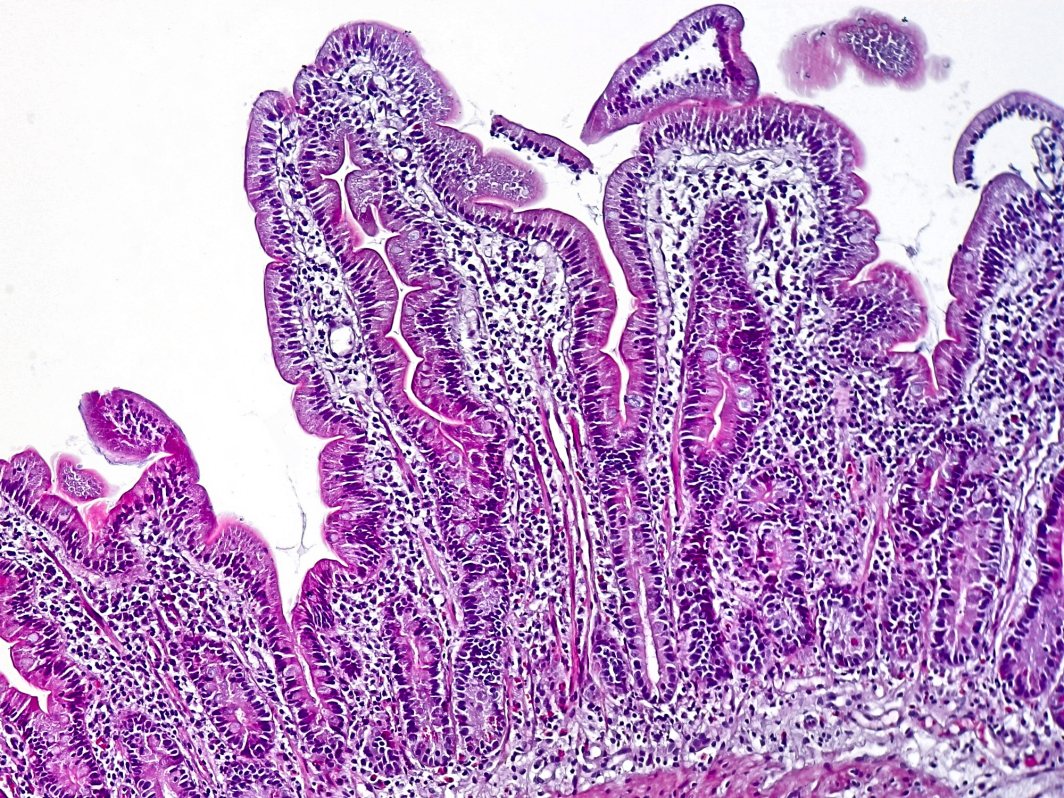 Healthy duodenum under the microscope
