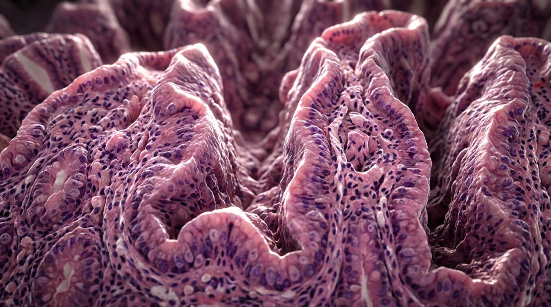 Stomach lining under the microscope