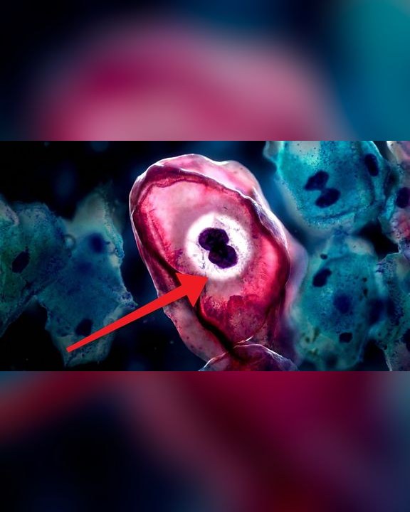 Video thumbnail: Human papillomavirus (HPV): we saw the virus almost everyone will get