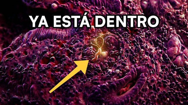 Video thumbnail: H. pylori: the bacterium living in your stomach right now that can cause cancer