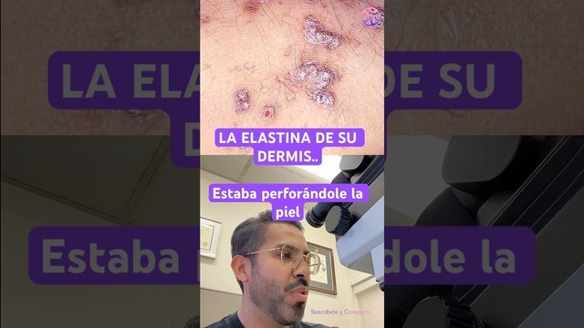 Video thumbnail: His skin was screaming that his kidneys were failing