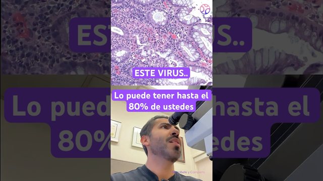 Video thumbnail: The virus that lies dormant in 80% of you right now