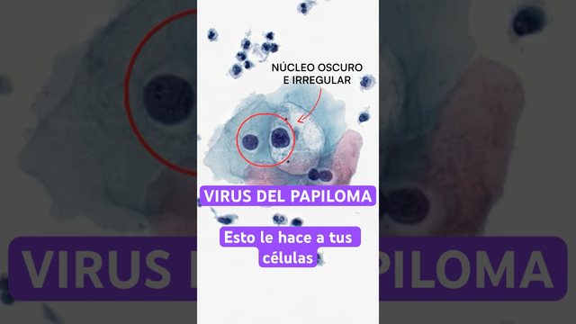 Video thumbnail: HPV: this is what it looks like while infecting your cells