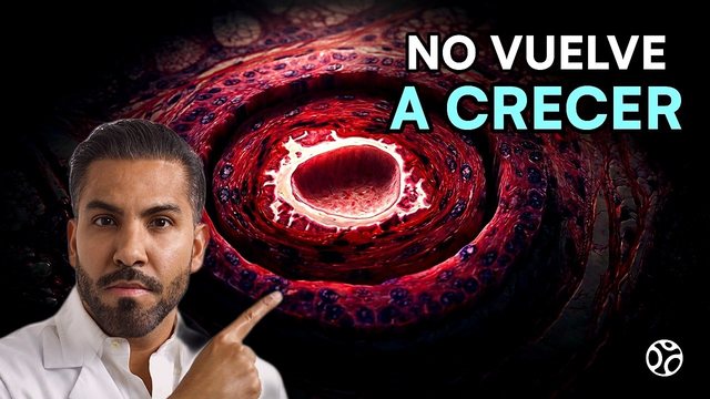 Video thumbnail: Alopecia: why hair falls out and which types can be treated