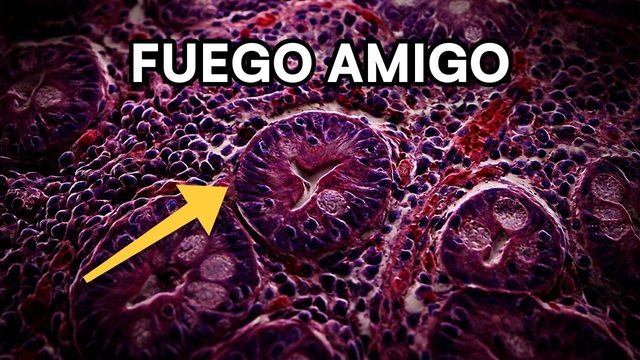 Video thumbnail: Gluten: your own body attacks your intestine (celiac disease explained under the microscope)