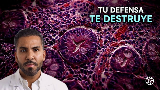 Video thumbnail: Gluten: the truth about celiac disease that almost no one explains
