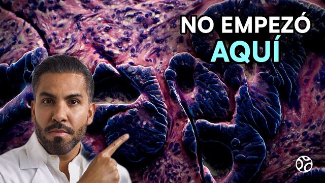 Video thumbnail: They found several tumors in his liver .. but the cancer started somewhere else