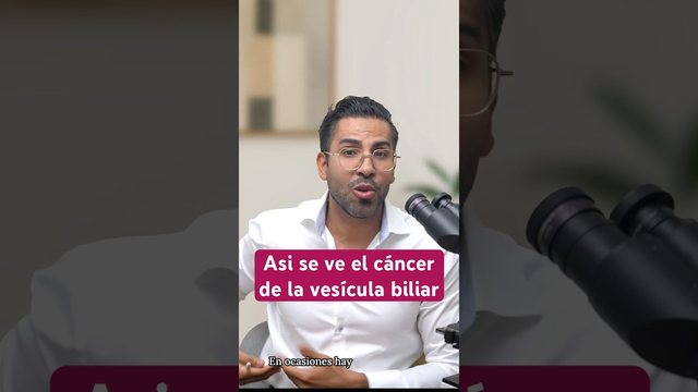 Video thumbnail: What gallbladder cancer looks like