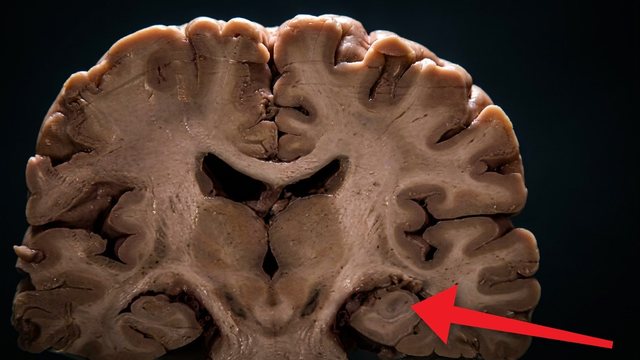 Video thumbnail: What alcohol really does to your body, one drink at a time