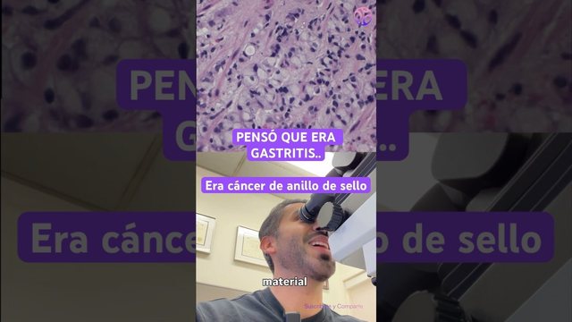 Video thumbnail: He thought it was gastritis .. it was signet ring cell cancer