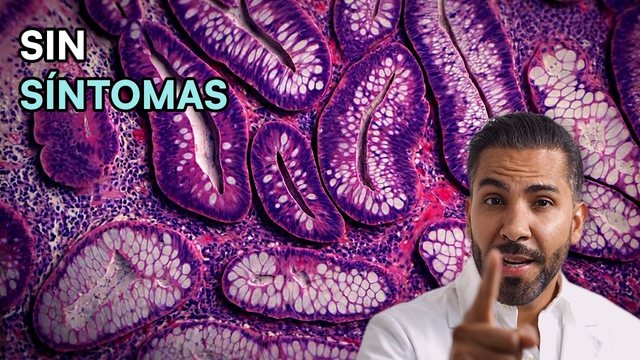 Video thumbnail: A colon polyp: harmless or the first step toward cancer?