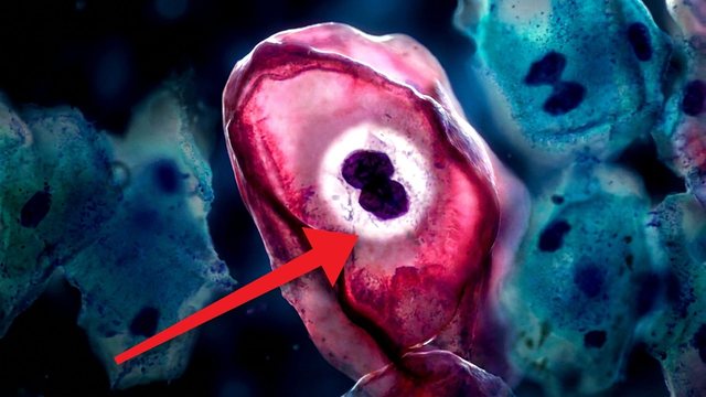 Video thumbnail: Human papillomavirus (HPV): we saw the virus almost everyone will get